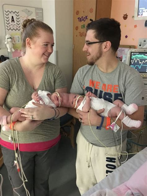 5 Months After Life Changing Surgery, Former Conjoined Twins Are ...