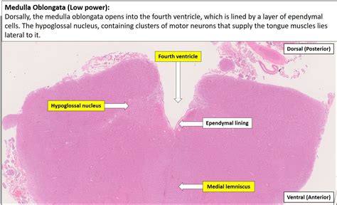 Brain – Medulla – NUS Pathweb :: NUS Pathweb