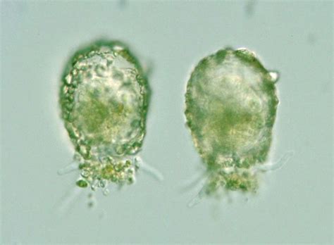 Protist Images: Difflugia pristis