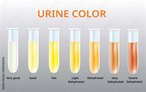 Urine Smells Smoky? 7 Amazing Causes With Remedies