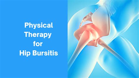 Bursitis — Blog -Mangiarelli Rehabilitation