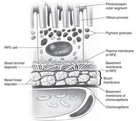 Basal laminar deposits and basal linear deposits t - American Academy ...