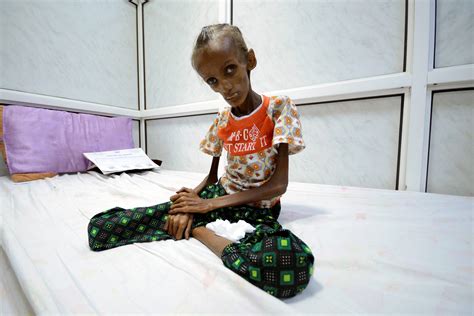 This picture of a starving girl shocked the world. – World Economic ...