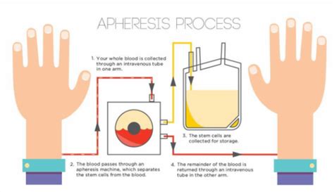 BB Exam 4: Apheresis Flashcards | Quizlet