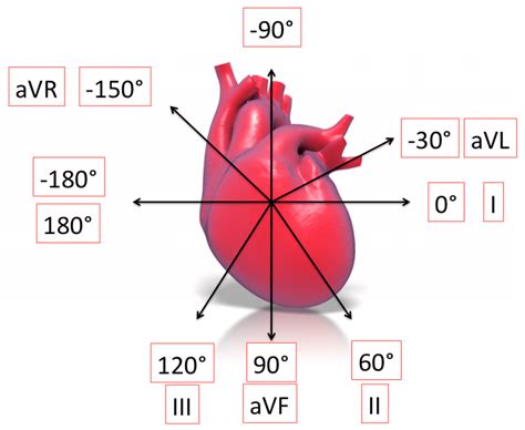 ECG Basics - R.E.B.E.L. EM - Emergency Medicine Blog