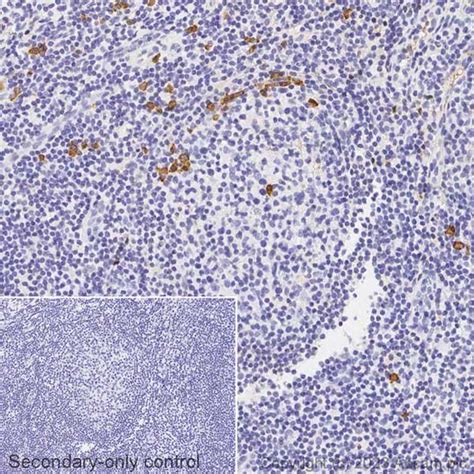 Recombinant Biotin Anti-Human IgG antibody [EPR4421] (ab314397) | Abcam