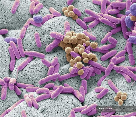 Scanning Electron Microscope Images Bacteria