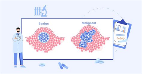 What Is A Malignant Neoplasm? - Health365.sg