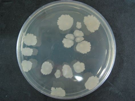 Bacillus subtilis1 | Bacillus, Bacillus subtilis, Microbiology