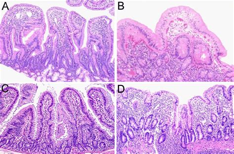 Human Duodenum Histology