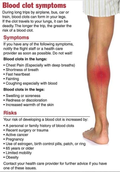 Deep Vein Thrombosis Signs And Symptoms | Hot Sex Picture