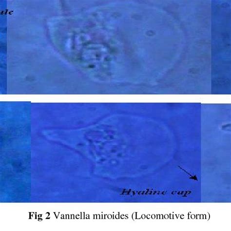 Trophozoite of Balamuthia mandrillaris | Download Scientific Diagram