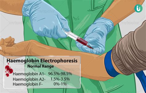 Hemoglobin Electrophoresis