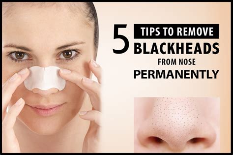 How Can I Remove Blackheads On My Face : Nose strips get a grip of the ...