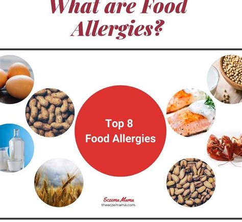 What Are Food Allergies? - Allergy, Asthma & Sinus Center, P.C.