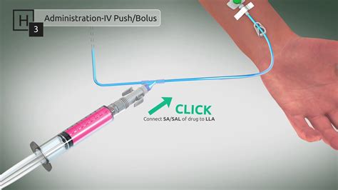 Chemfort® CSTD - Administration IV Push Bolus - YouTube