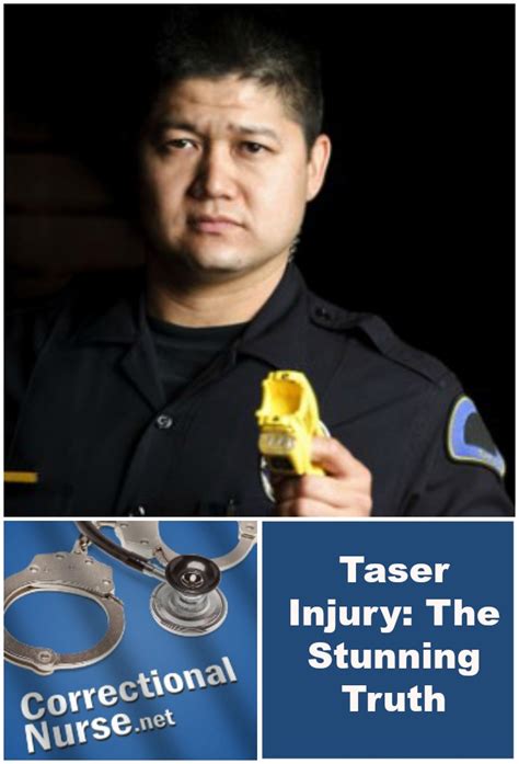 Taser Injury: The Stunning Truth - Correctional Nurse . Net