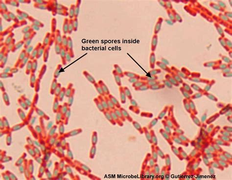 Spore Stain