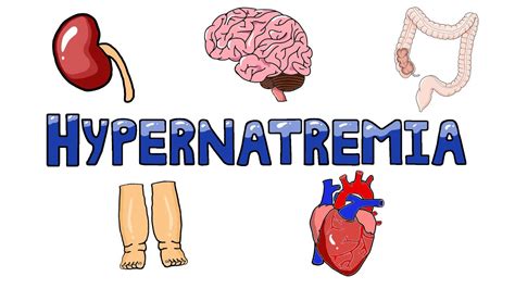 An Approach to Hypernatremia - Hypernatremia Diagnostic Algorithm ...