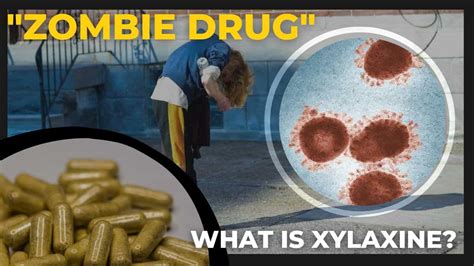 What Is Xylazine? How Is The Drug 'Zombifying' People’s Bodies? All You ...