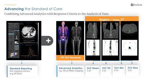 Neurocience Imaging | CNS Drug Development & Clinical Trials | Invicro