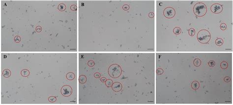 Diagnostics | Free Full-Text | Effects of Escherichia coli and Proteus ...