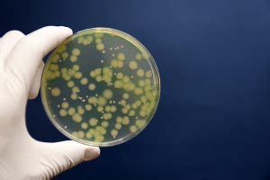 Pseudomonas aeruginosa, Pseudomonas Testing