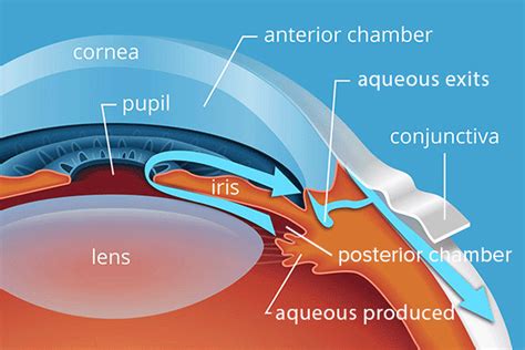 Intraocular Pressure - All About Vision