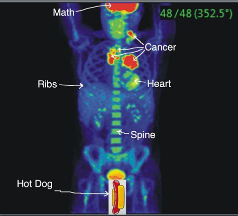 Medium Times: Scan results