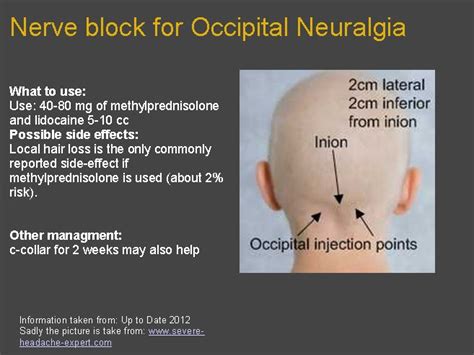 THE A.D.D. E.D.: nerve block for occipital neuralgia