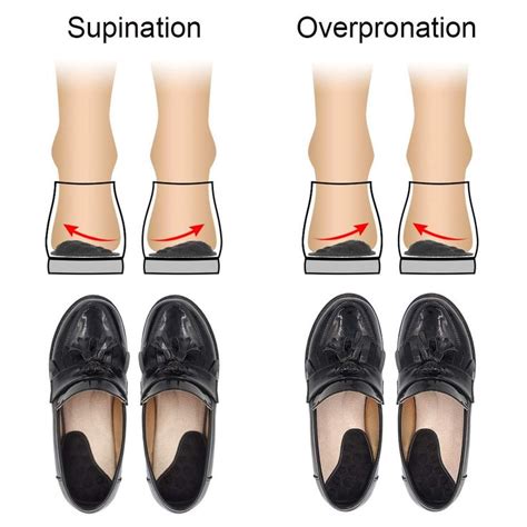 Dr. Foot's Supination | Shoe inserts, Overpronation, Oxford shoes