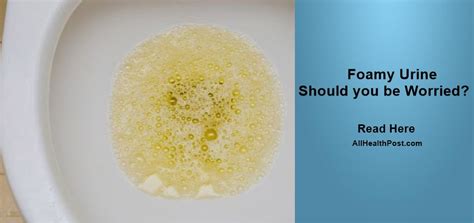 Foamy Urine 】- Should You be Worried? Is it Normal?