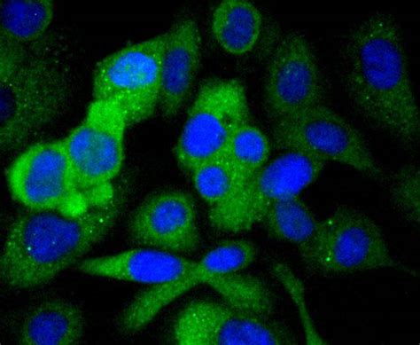 Paxillin Rabbit mAb - SAB | Signalway Antibody