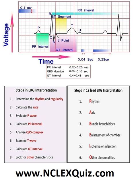 10 Steps to Learn ECG Interpretation - NCLEX Quiz