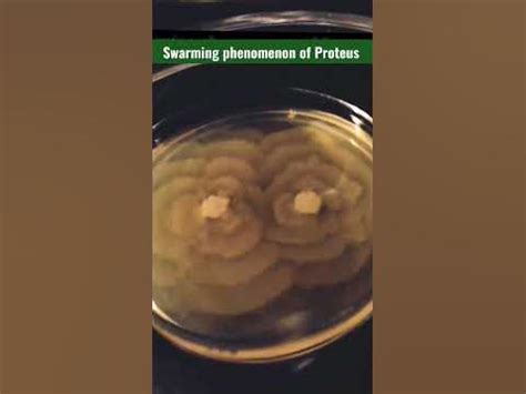 Swarming phenomenon of Proteus mirabilis #Microbiology # ...