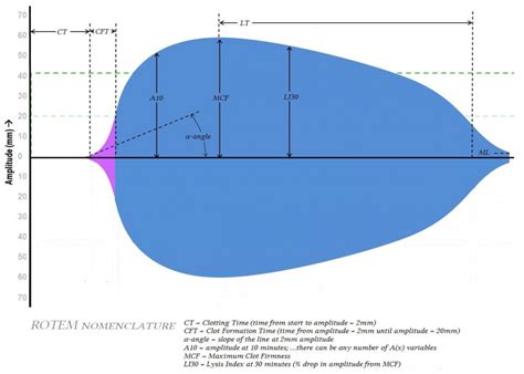 ROTEM in Trauma: Blood is thicker with Wine - Part 2 - EMOttawa