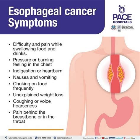 Understanding Esophageal Cancer: Causes, Symptoms, and Prevention