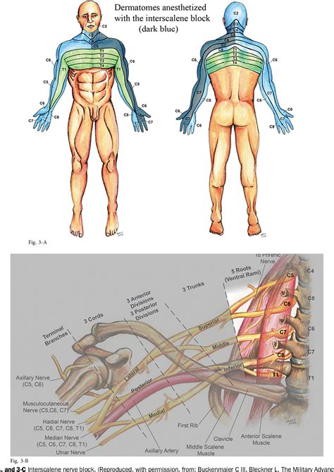 Figure 1 from Upper-extremity peripheral nerve blocks in the ...