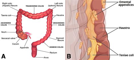 Pseudo-Obstruction - TeachMeSurgery