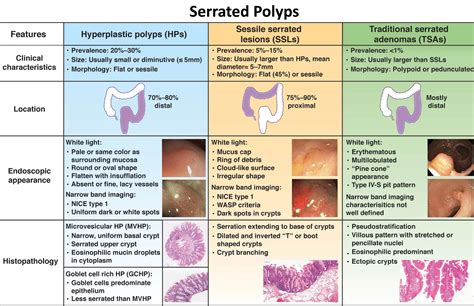 Hyperplastic Polyposis Syndrome