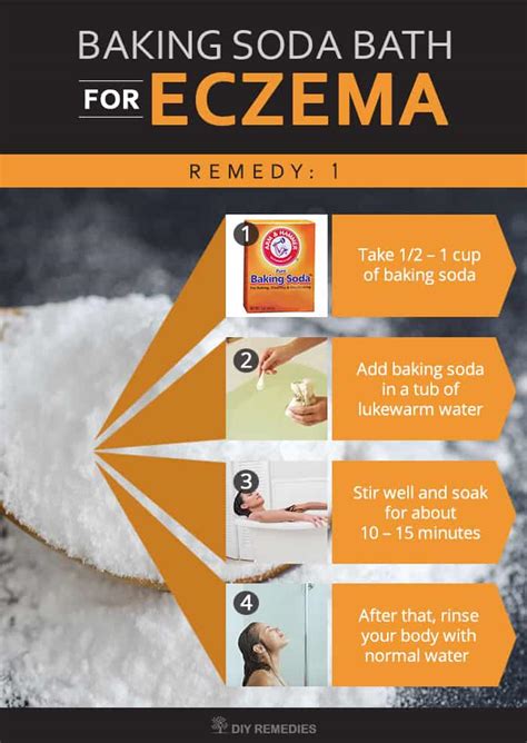 How to Soothe Eczema with Baking Soda