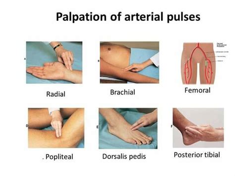 Medical-Online - A pulse represents the tactile arterial...