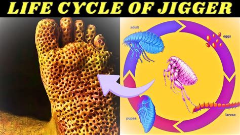 Unveiling the Jigger Flea: Life Cycle and Impact on the Human Body ...