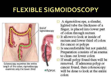 Colorectal Cancer Anatomy of the Colon and Rectum