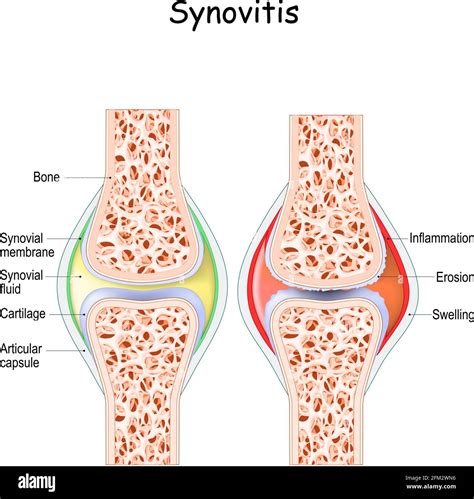 Synovial Membrane