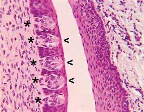 Microvilli - Definition, Diagram (Vs Villi and Cilia) and Function ...