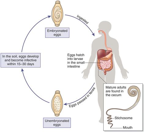 Image result for trichuris trichiura life cycle | Life cycles, Life ...