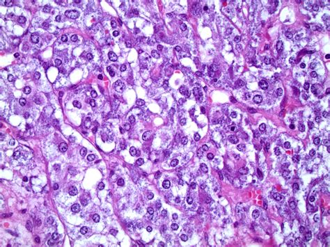 Pathology Outlines - Histology - Adrenal medulla