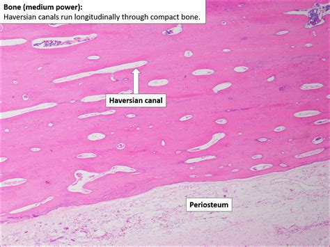 Bone – Normal Histology – NUS Pathweb :: NUS Pathweb