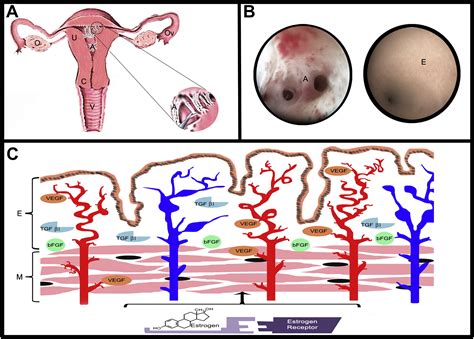 Efficacy of Estrogen Therapy in Patients With Intrauterine Adhesions ...